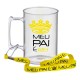 Tirante para Caneca de Chopp Personalizado 15mm